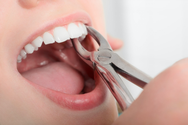 عيادة جراحة الأسنان